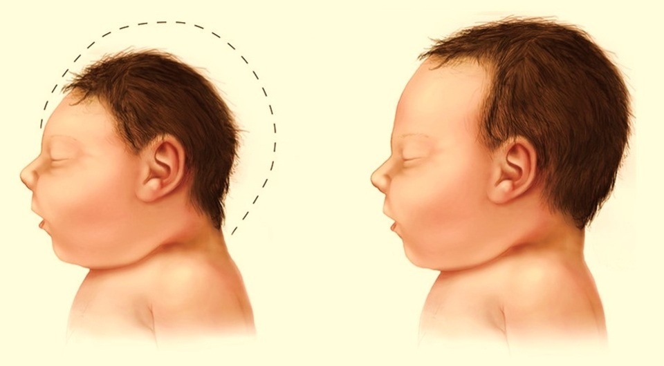   Bolly Holly Baba / Flickr / CC BY 2.0