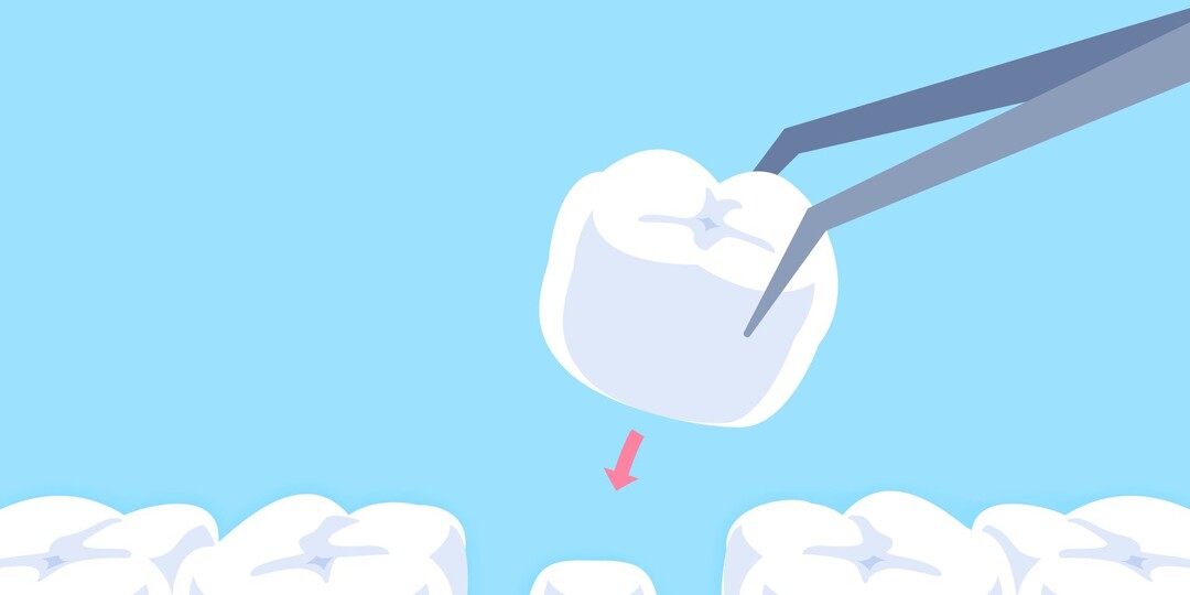 Что «убивает» коронки? Разоблачаем 10 «убийц»!