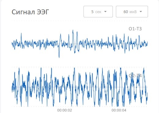 До сеанса: активность сосредоточена в левом полушарии, где формируются образы и мысли. Человек может много размышлять, строить планы, но движение вперед останавливается
