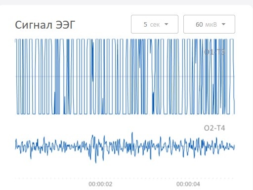 После сеанса: активируется правое полушарие, связанное с действиями и принятием решений. Клиент описывает ясность, понимание шагов, появляется энергия для реализации