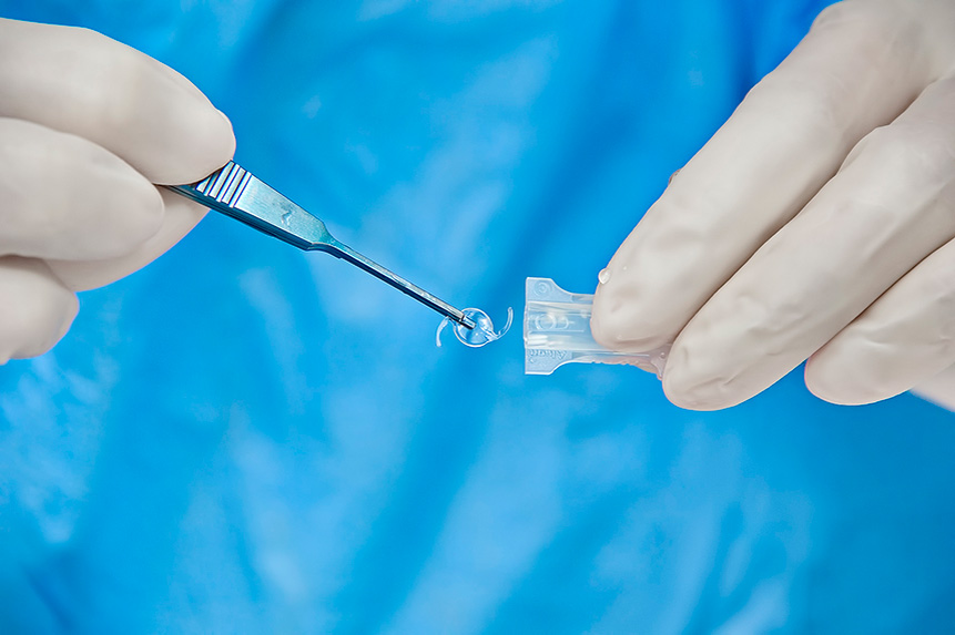 Укладка интраокулярной линзы (искусственного хрусталика) в инжектор для проведения имплантации