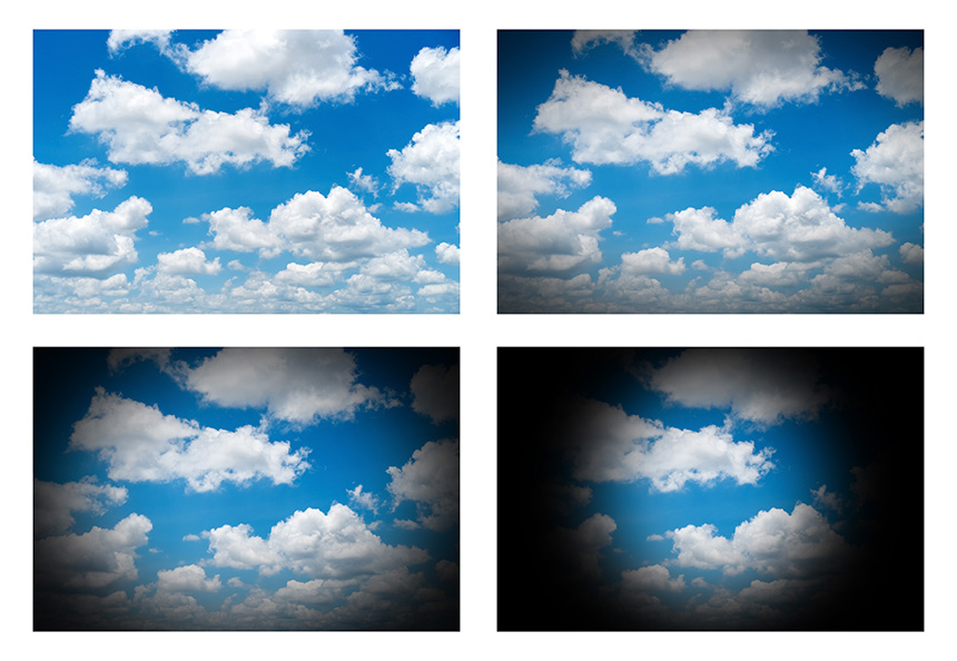 Постепенное выпадение полей зрения по глаукомному типу