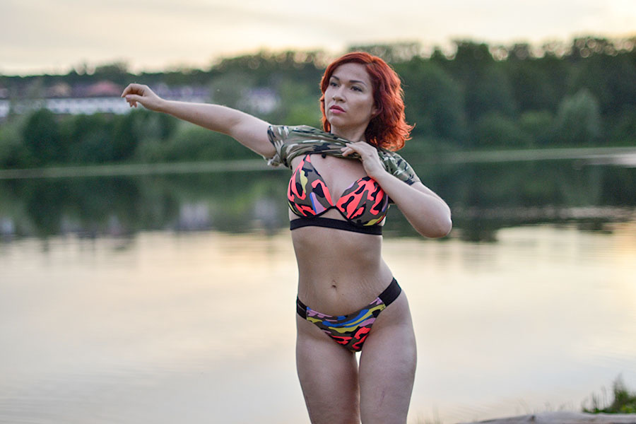 Прикреплю-ка я свою старую фотку сюда, это 2017 год. Если присмотреться, то видно растяжки. А можно и не присматриваться, а жить дальше! 