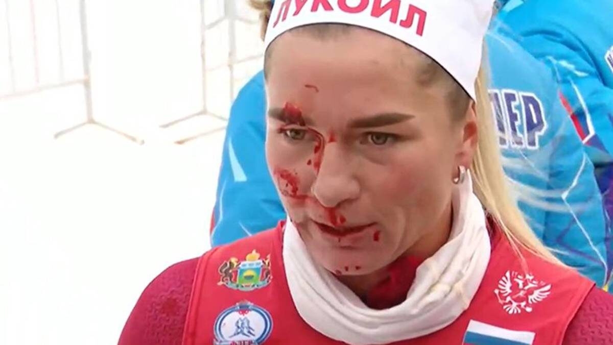    кадр из трансляции