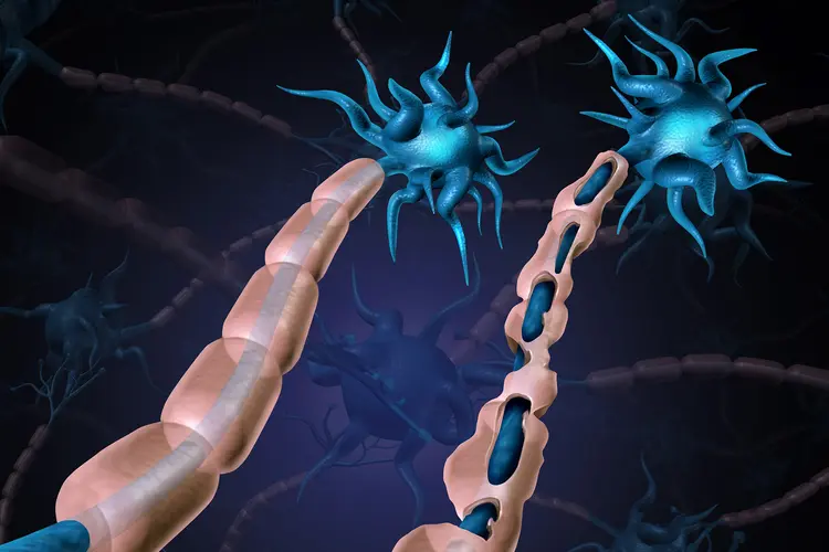 Сначала поражается миелиновая оболочка, а затем и сами нервные волокна