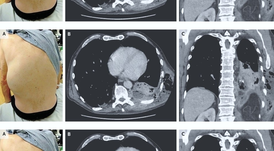   Adeoluwa Ayoola and Kreshnik Zejnullahu / The New England Journal of Medicine, 2025