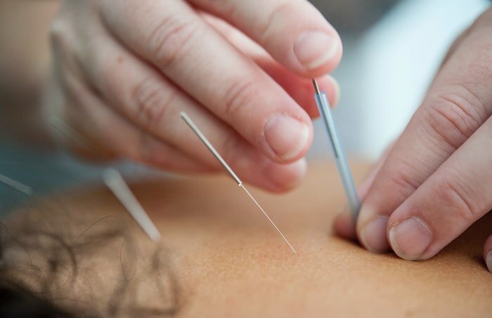 IELTS Sample Essay: does alternative medicine work?