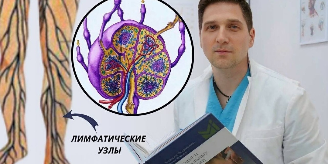 Забитая лимфа: 6 тревожных признаков и 5 действенных способов ее разгона. Домашний тест, который определит застой