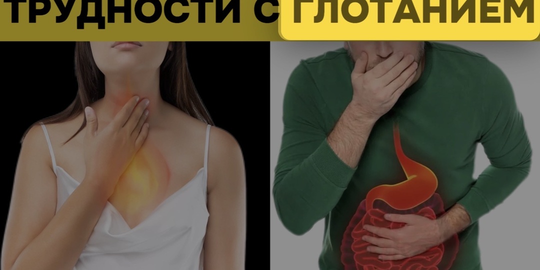 Онколог объяснил, почему первые симптомы рака пищевода похожи на изжогу