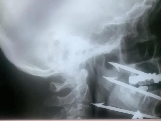    Фото: vk.com/volgazdrav