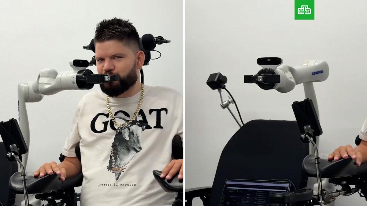    Фото: neuralink / X