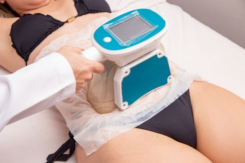 В криолиполизе результат во многом зависит от выбранного аппарата и его технологии охлаждения