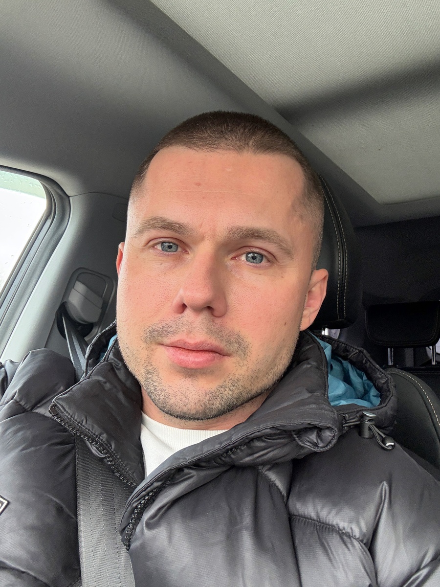 LADA часто манифестирует в возрасте 35-50 лет