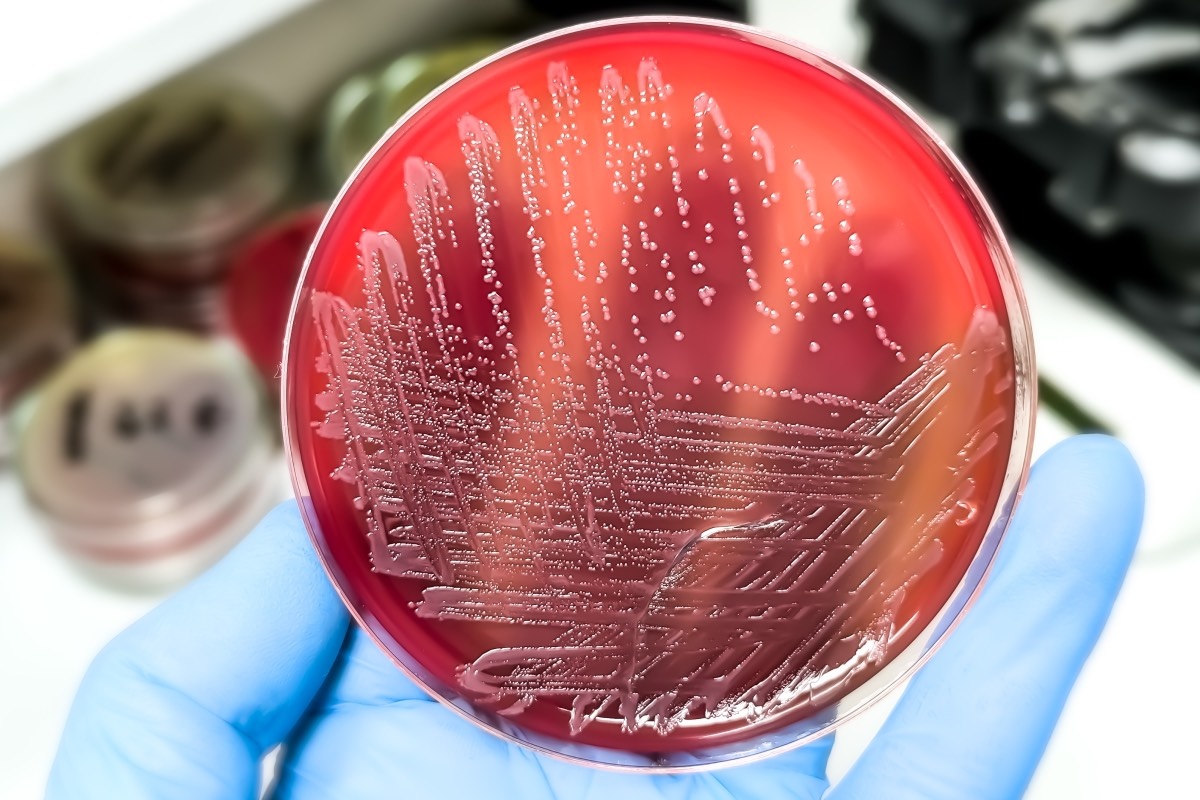 Saiful52 / Shutterstock / FOTODOM📷Определить наличие сальмонеллы на глаз невозможно, предупреждают эксперты