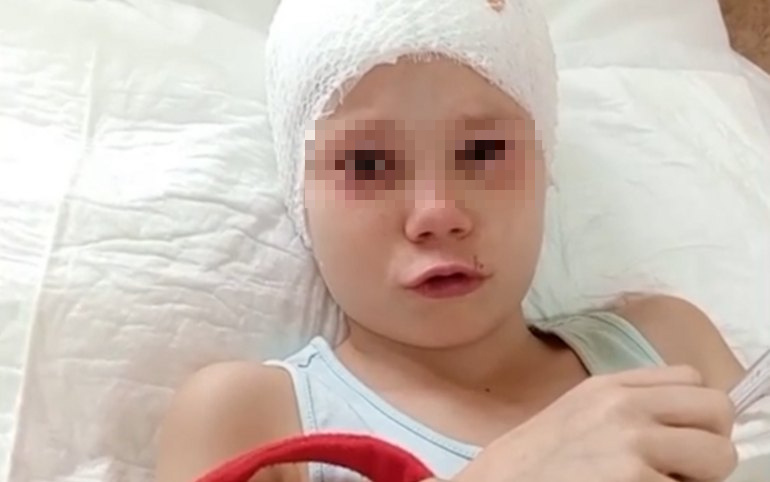 Овчарка вырвала косу 7-летней девочки вместе с частью кожи. Не допустить трагедии получилось у случайного прохожего — им оказался подросток