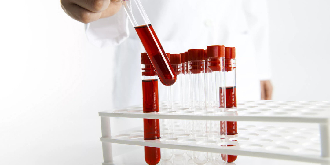 Следи за цифрами — сохрани зрение, почки и ноги: главные анализы, которые спасают жизнь при диабете