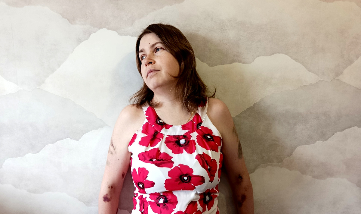 Валерия после курса лечения в Москве. Изображение из личного архива героини публикации.