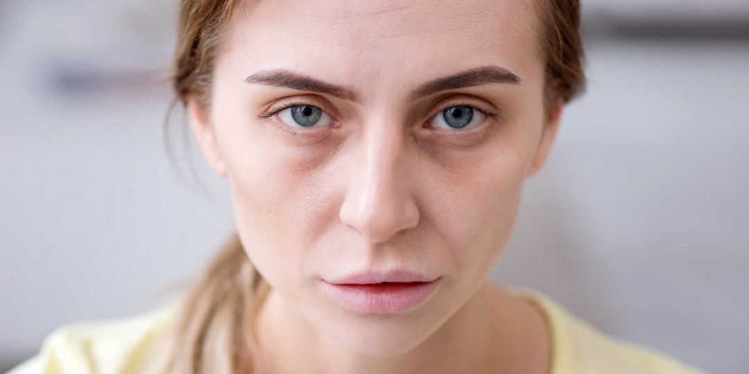 Как распознать нехватку витаминов по простым признакам