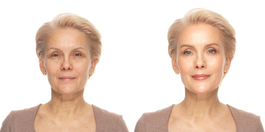 Подтяжка лица без операций: как работают скульптор и румяна?