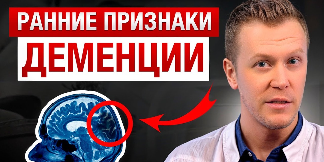 Как заподозрить раннюю деменцию: четыре первые сигналы