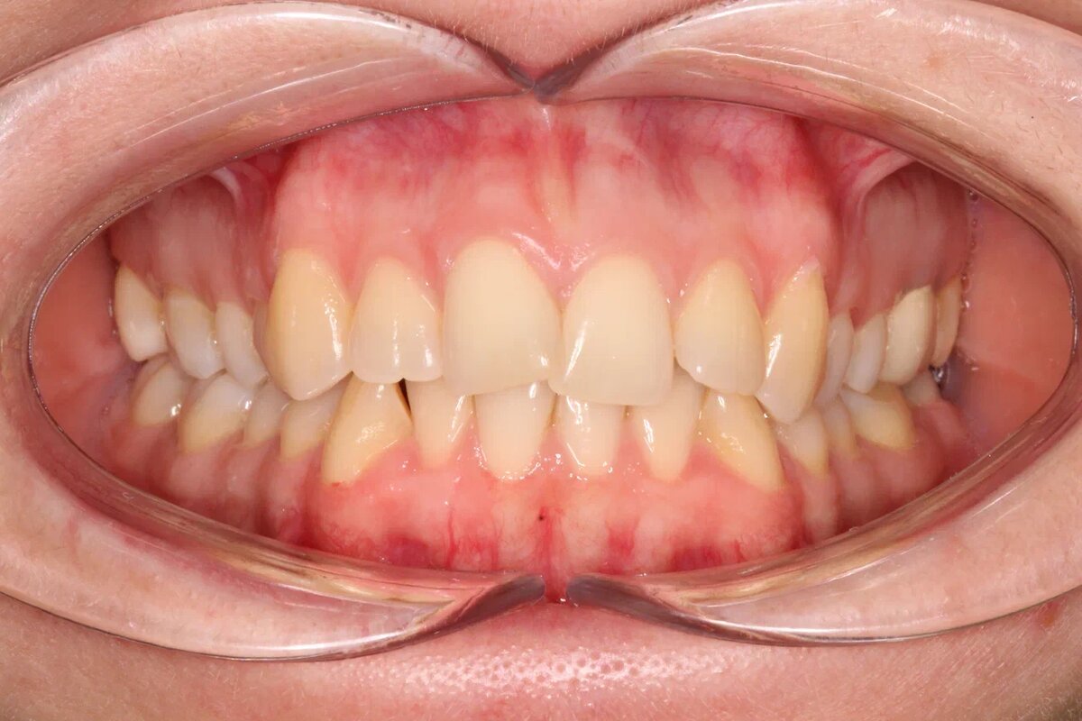 Исходная ситуация