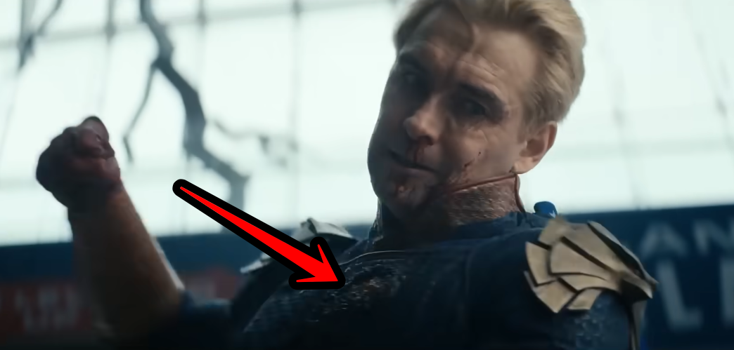 Хоумлендер в пятом сезоне сериала "Пацаны (кто из супергероев оставил ему ожог?)