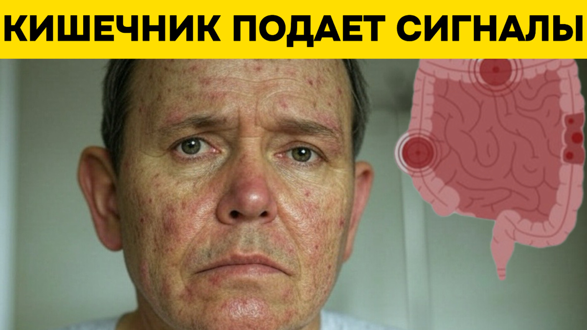 Ощущение неполного опорожнения кишечника