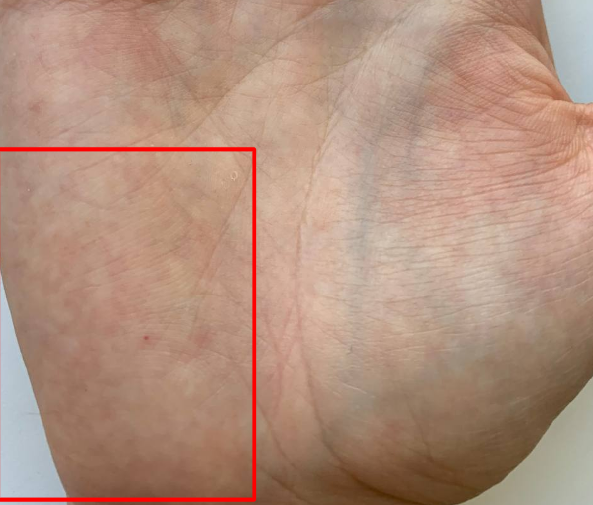 Фото 1,5 года назад