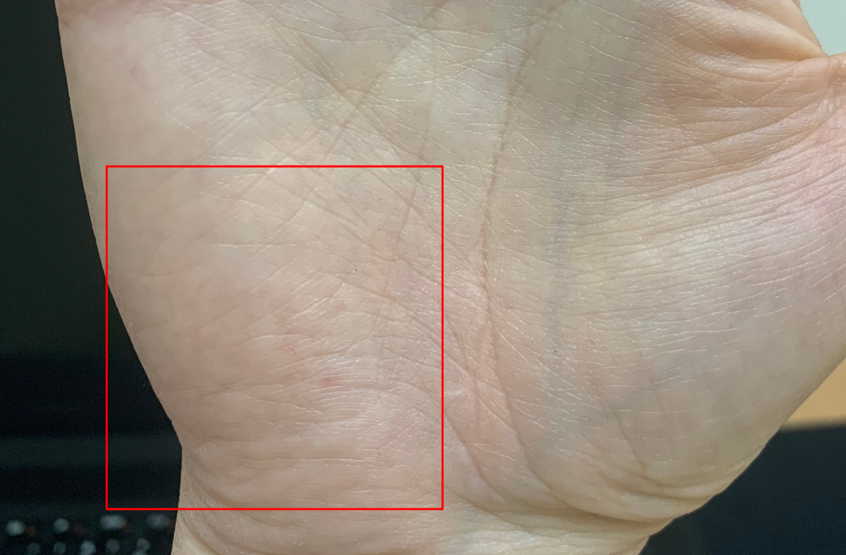 Холм Луны сейчас