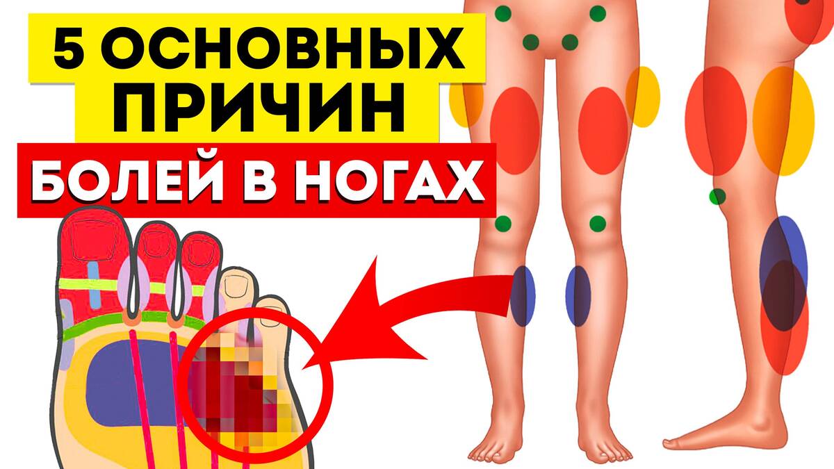 Почему ночью сводит ноги: органы, которые могут давать такой симптом