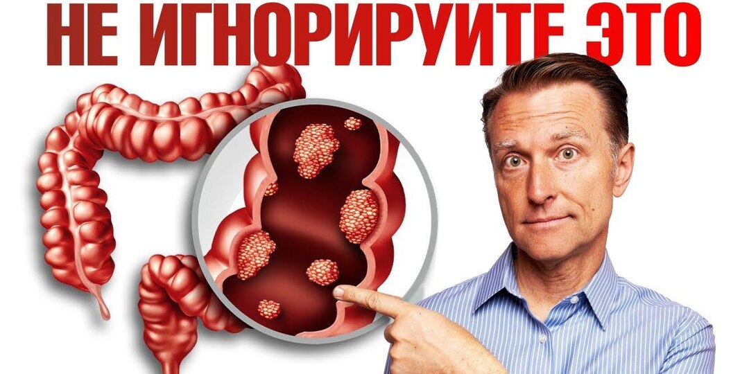 Как болит кишечник при онкологии: объяснение специалистов — 7 признаков, которые 88 % людей принимают за «геморрой»