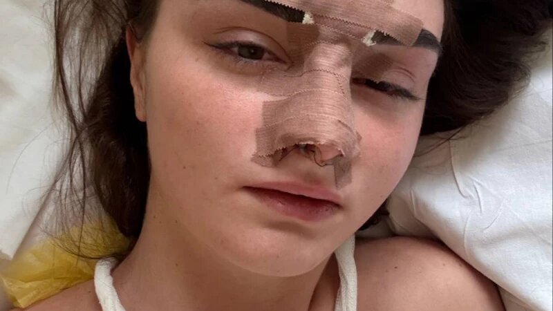     Российский спортсмен избивал свою жену. Телеграм-канал «Осторожно, новости»