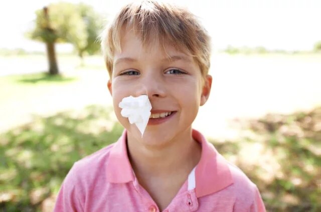    Как быстро остановить кровотечение из носа?