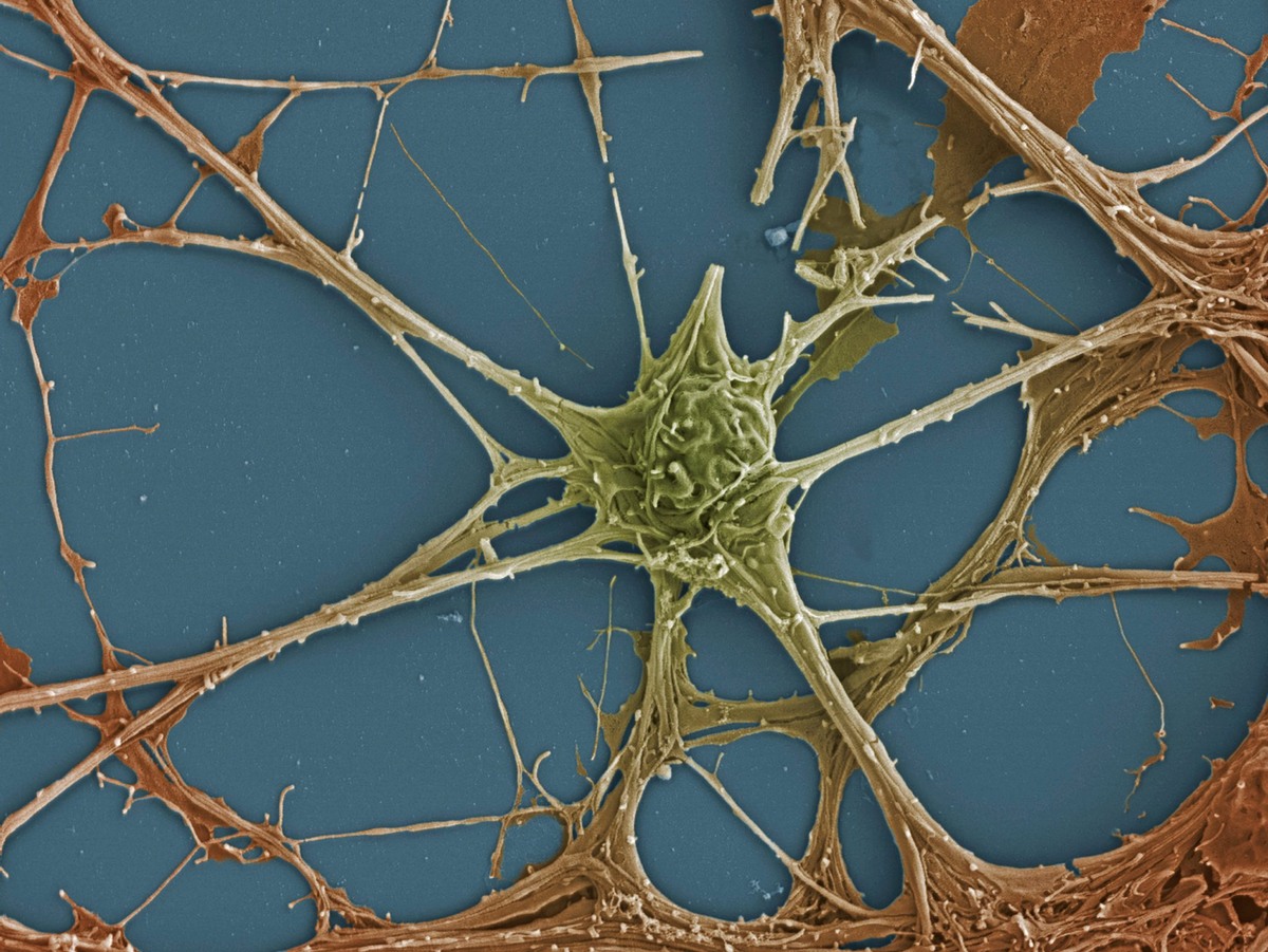 Нейрон - удивительно сложная и активная клетка.