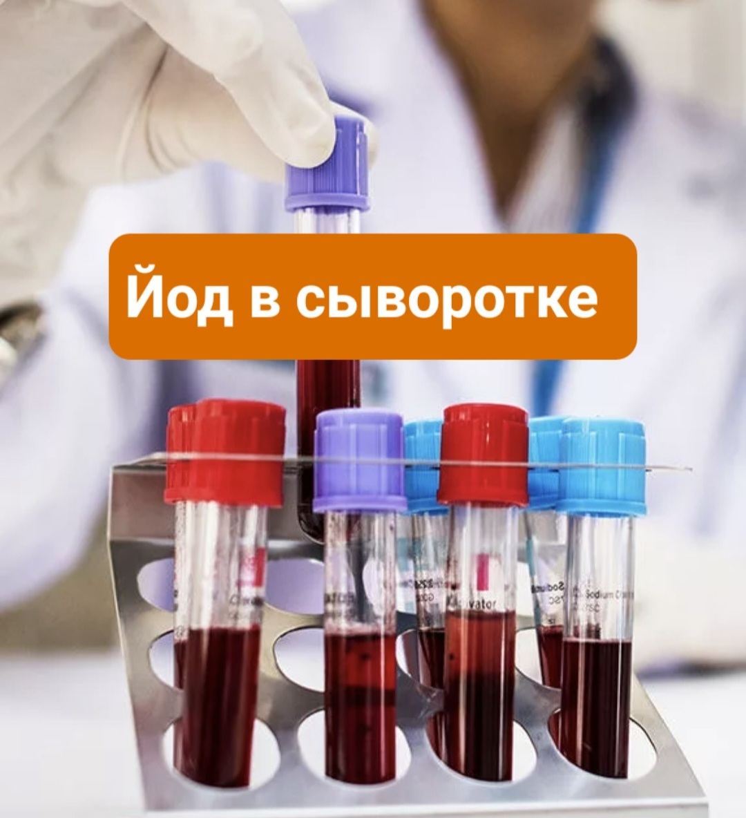 Йод в сыворотке - сиюминутный показатель