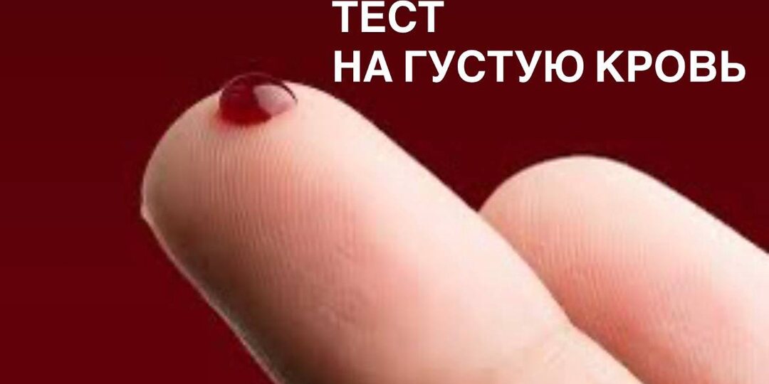 Как понять, что у вас густая кровь: 9 тревожных сигналов, которые нельзя игнорировать, и 6 простых методов разжижения крови +упражнения