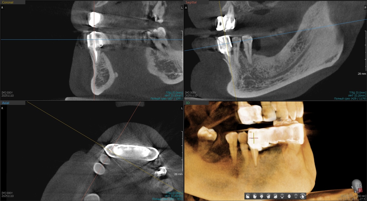 КТ до - отправлено пациентом нам на почту