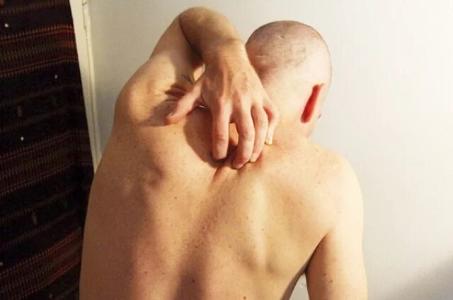    Почему может чесаться всё тело?