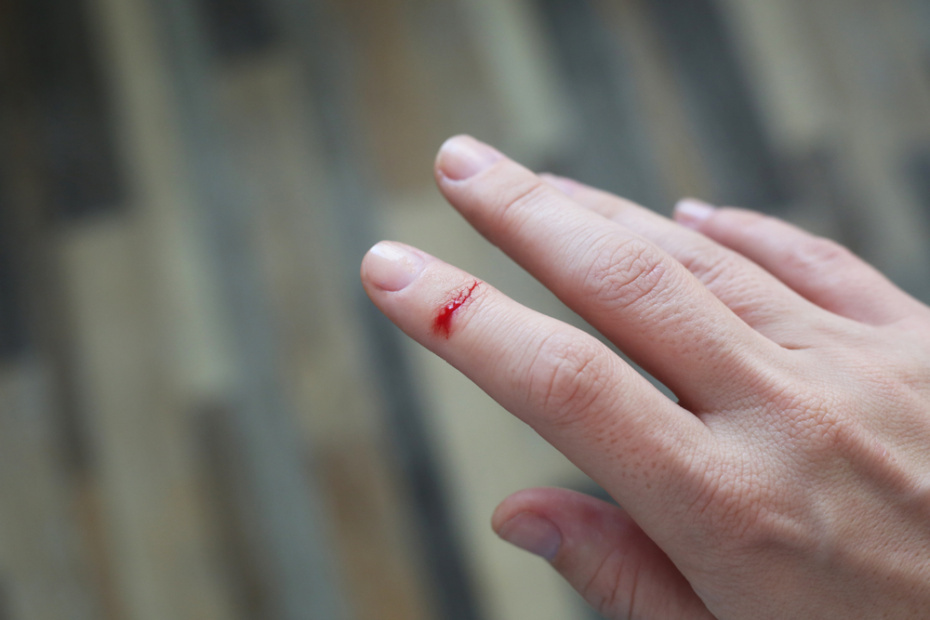    Shutterstock/FOTODOM