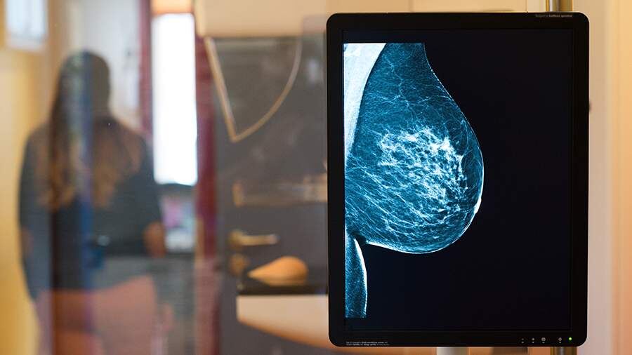    Фото: TASS/Klaus-Dietmar Gabbert