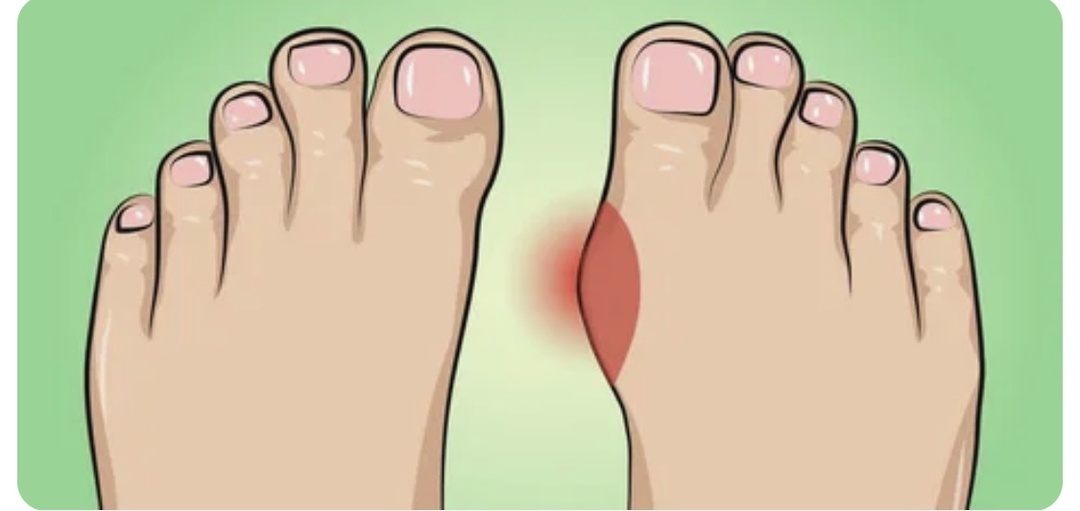 Скажем «прощай» косточкам на стопах: 6 упражнений, а заодно и стопы расслабим