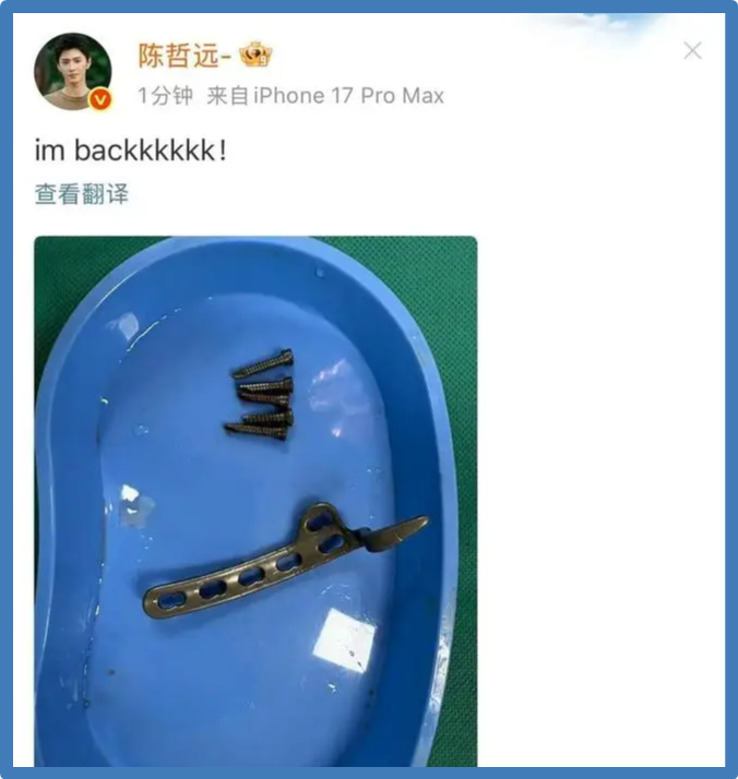 Железные штифты.