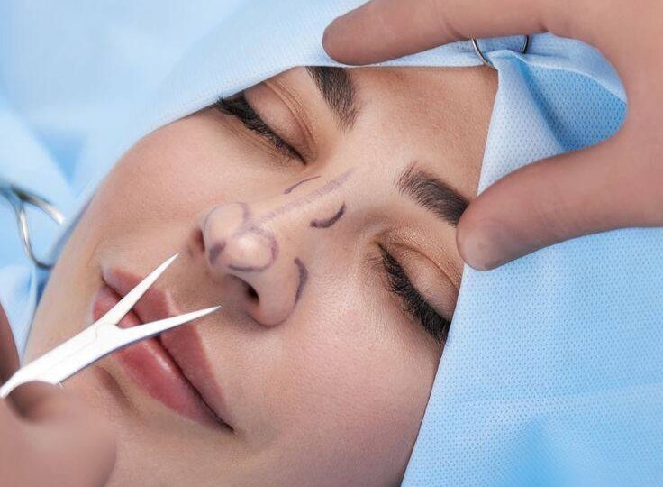 Правда и мифы о септопластике