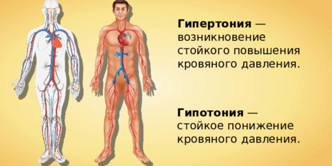 Гипотония . Причины и лечение