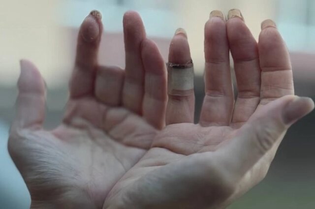    Так сейчас выглядят руки стилистки-альпинистки Фото: Из личного архивa/ Виктория Кононова