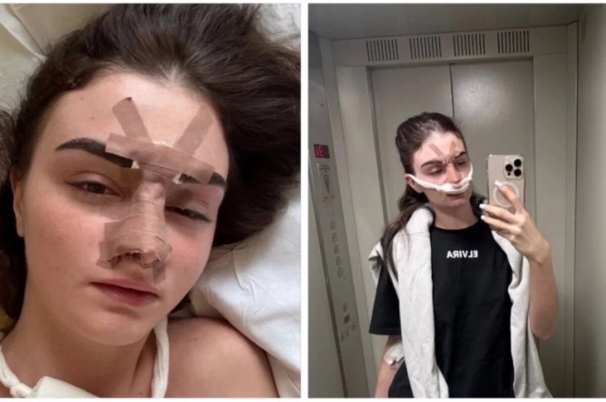    Фото из больницы пострадавшая разместила в своих Соцсетях