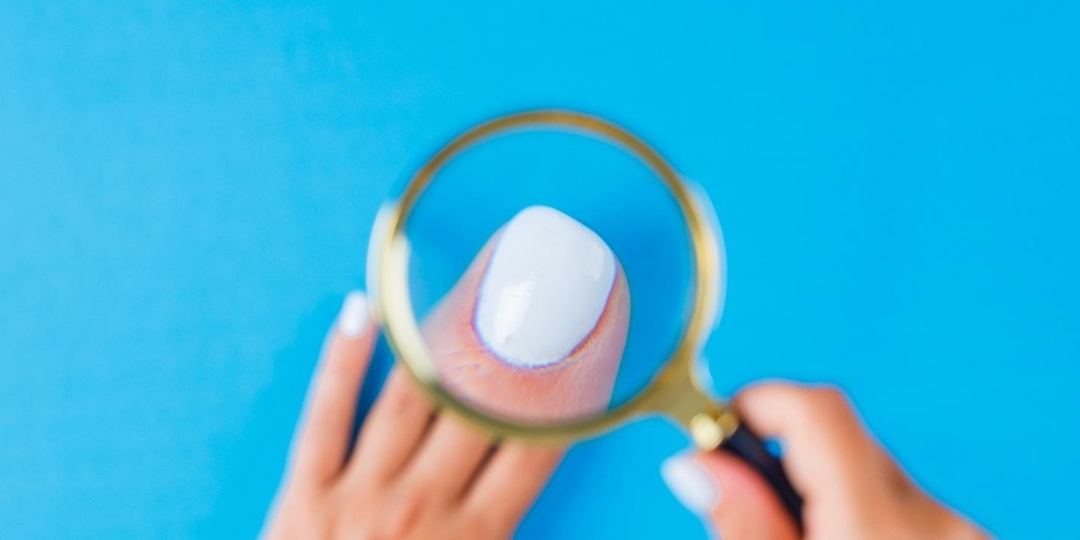 Онихолизис — почему «отваливается» ноготь и что с этим делать