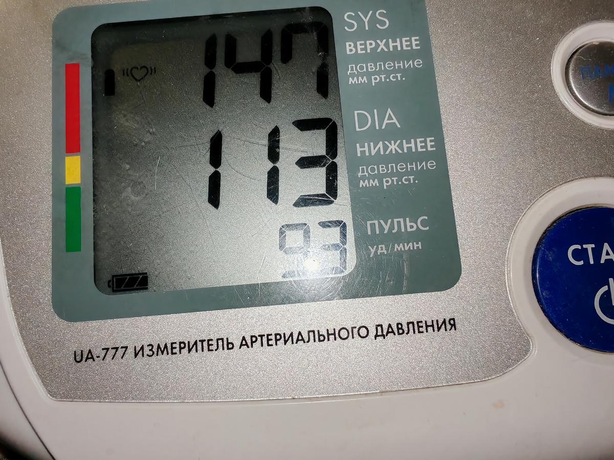 Масксимально вверху... 