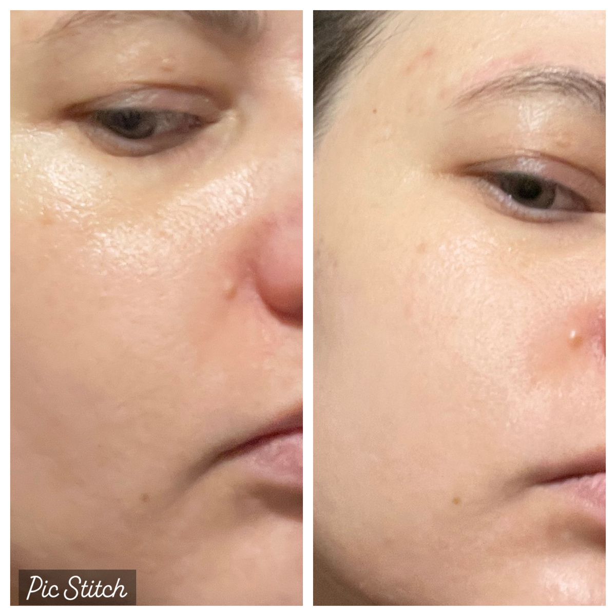 Слева - лицо после нанесения сыворотки, справа - после нанесения крема