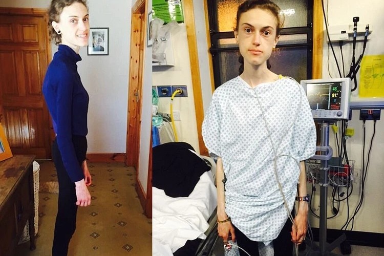 Эмили снова начала носить свою детскую одежду и верила, что с ней все в порядке, даже когда ее положили в больницу. Фото: соцсети